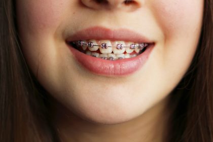 4 самых неприятных вещи в женской внешности с точки зрения мужчин